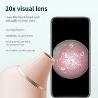Thumbnail for SkinClear-Camera AI Visual Blackhead Remover